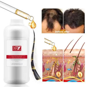 1 Liter Ginseng Anti Hair Loss Tonic for Hair Loss Treatment Hair Growth Serum