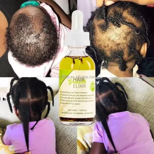 100% Natural Formula Nourishing Scalp Elixir Castor Rosemary Oil Hair Care Loss Treatment Hair Growth Oil Serum
