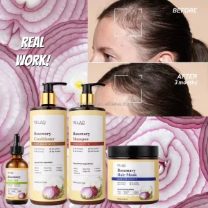 100% Natural Herbal Rosemary Oil With Onion Biotin Hair Fuller Loss Shampoo Set Hair Growth Oil Strengthening Shampoo Set