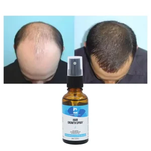 100% Natural Organic Hair Growth Oil Private Label Anti-Dandruff Hair Regrowth Serum for Men and Women Hair Loss Treatment