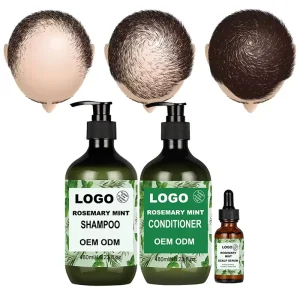 100% Organic Anti Hair Loss Shampoo Hair Regrowth OEM/ODM