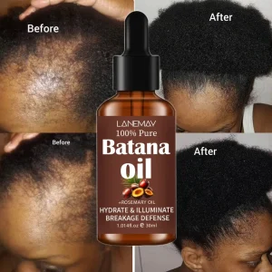 100% Pure Natural Organic Rosemary Oil Essential Oil Batana Oil for Hair Growth and Skin Care