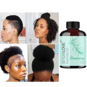 118ML Rosemary Oil Women Serum Hair Regrowth Serum Biotin Anti Hair Loss Fall Serum Hair Growth Oil for Women