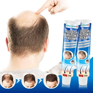20g Alopecia Hair Growth Root Lifting Cream Herbal Formula Anti Hair Loss Treatment Unisex Adults Promote Hair Growth