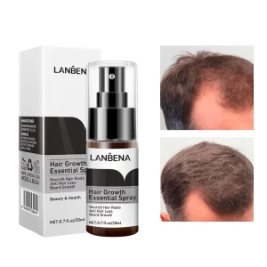 20ml Herbal Anti Hair Fall Non Greasy Nourishing Natural Hair Care Mist Thickening Spray Ginger Hair Growth Spray