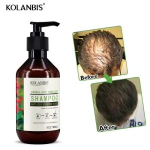 300ml Organic Growth Faster Stop Hair Loss Cosmetics Cure Baldness Shampoo