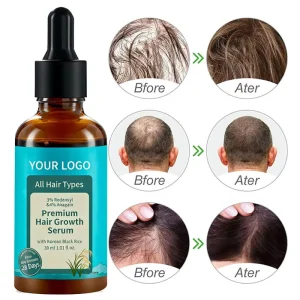 30ml Hair Treatment Serum Natural Anagain Redensyl Biotin Rosemary Hyaluronic Acid Heat Protection Hair Growth Oil