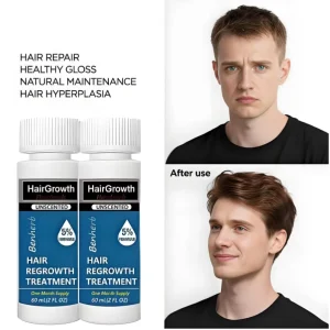 5% Herbal Nourishing Hair Growth Oil 60ml Tonic Serum for Normal Hair Regrowth Care Organic Biotin Concentrated Formula for Men