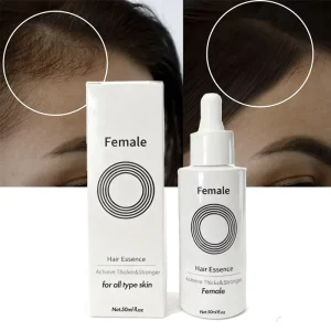 50ml New Exo Hair Scalp Booster Serum Anti Hair Loss Hair Growth Oil Serum Nourishing Scalp Rapid Thickening Oil for Women