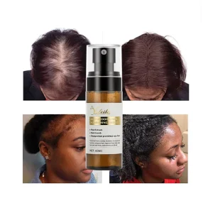 60ml 100% Natural Organic Hair Regrowth Tonics Scalp Serum Massage Oil Hair Growth Spray