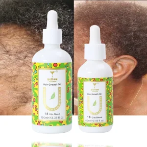 60ml Scalp Care Hair Growth Oil Vegan Black Hair Loss Treatment Ginger Hyaluronic Acid Coconut Oil Refreshing