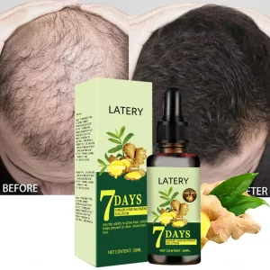 7 Day Fast Hair Growth Oil Ginger Anti Hair Loss Treatment Scalp Nourishing Hair Regrowth Strengthening Serum