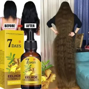 7 Day Fast Hair Growth Oil Ginger Growth Hair Treatment Anti Hair Loss Men Women Scalp Treatment Serum