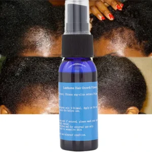 7 Days Organic Ginger Spray Essential Oil for Hair Growth Refreshing Anti Dandruff and Hair Repairing Hair Growth Serum
