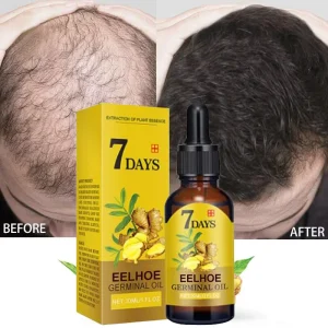 7 Days Rapid Hair Growth Essence Oil Hair Loss Treatment Growth Hair Care Essential Oil