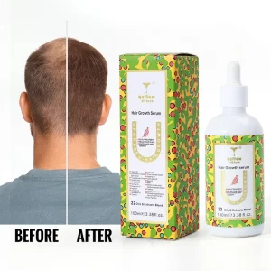 7days Ginger Oil Rosemary Hair Growth Oil Serum for Hair Growth Oil for Black Women