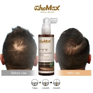 AHCMAX Plus Hair Growth Spray Cistanche Supplement Set Ginger Coconut Oil 2 IN 1 Formula Fast Acting Hair Regrowth Density