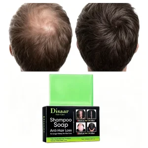 Anti Hair Loss Shampoo Bar for Hair Growth & Regrowth Natural Ginger & Polygonum Herbal Shampoo Soap for Thinning Hair