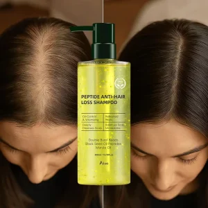 Anti Hair Loss Shampoo Moisturizing Hair Growth Treatment Natural Plant Extracts Hair Cleaning Shampoo Private Label OEM ODM