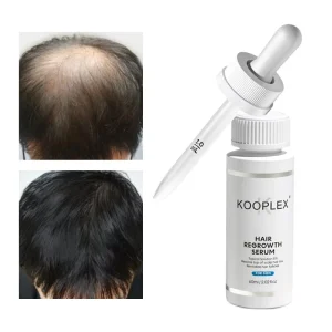 Anti Hair Loss Treatment Serum Oil Hair Regrowth Care Rosemary Biotin Hair Growth Serum Oil for Men and Women