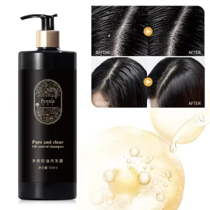 Anti Loss Shampoo Nourishing Shampoo Natural Hair Care Hair Growth Shampoo