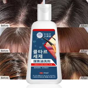 Anti dandruff Shampoo Hair Follicle Cleaning Oil Control Fluffy Hair Wash Cream Itching Inflammation and Mite Control
