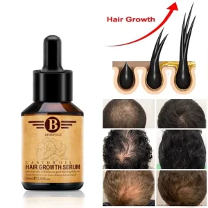Argan Oil & Herbal Hair Loss Treatment Fast Hair Regrowth Essential Oil 7 Days Anti loss Strong the Root Serum