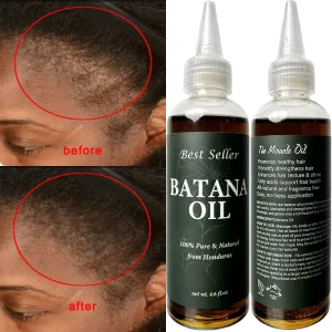 Batana Black Women’s Hair Growth Oil Veganic Natural Keratin Treatment with Rosemary Essential Oils Hair Serum