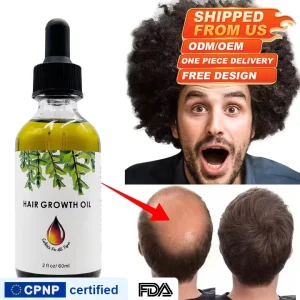 Best Hair Castor Rosemary Growth Treatment Natural Essential Oils Ginger Peppermint New American Custom Private Labels