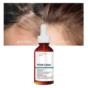 Best Serum Manufacturers Multi Peptide Serum for Hair Density Oem Hair Tonic Bottle Hair Regrowth Serum