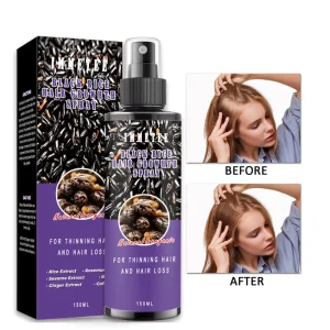 Black Rice Water Hair Growth Spray Anti Hair Loss Treatment Ginger Rosemary Scalp Serum for Thinning Hair Regrowth Mist