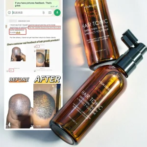 Caffeine Hair Growth Spray DHT Blocking Anti Hair Loss Scalp Nourishing Hair Tonic with Rosemary & Saw Palmetto Extract