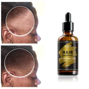 Chinese Anti Itch Regrowth Hair Oil With Logo Argan Growth Oil for African Hair