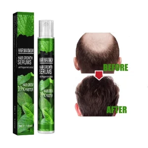 Chinese Herbal Hair Growth Serum Oil Anti depilation Moisturizing Hair Follicle Stronger and Longer Hair Nourishing Spray
