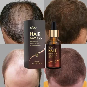Creme Pommades Pour Faire Produit Pour Pousser Mes Cheveux Rapidement Hommes Oil
