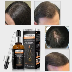 Cross border Ginger Hair Essential Oil for Scalp Care Leave In Nourishing Massage Oil Anti Frizz Hair Growth Oil