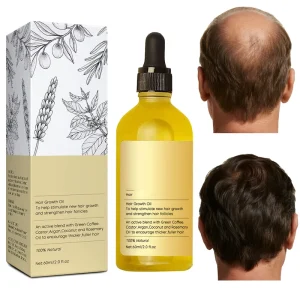 Custom 100% Natural Organic Rosemary Hair Scalp Care Treatment Regrowth Biotin Rosemary Essential Oil Growth Oil Serum