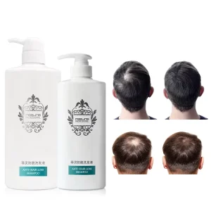 Custom Herbal Repair Shampoo Anti Hair Loss Natural Organic Hair Growth Ginger Shampoo