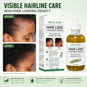 Custom Herbs Organic Herbal Natural Biotin Nourishing Regrowth Oils Rapid Rosemary Oil for Hair Growth Products Private Label