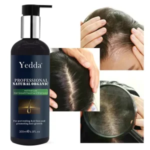 Custom Ingredients 200ml Anti Hair Loss Nourishing Dye Free Herbal Shampoo Hair Growth Treatment Set Organic All Natural Hair