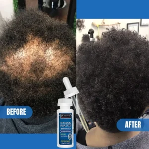 Custom Logo 60ML Kirland 5% Hair Growth Serum Kit Hair Regrowth Oil Hair Growth Product Anti Loss Treatment for Men