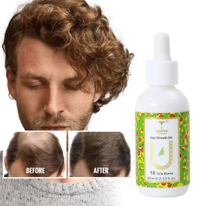Custom Logo 60ml/100ml Rosemary Peppermint Biotin Hair Growth Serum Hair Growth Oil Treatment for Regrowth
