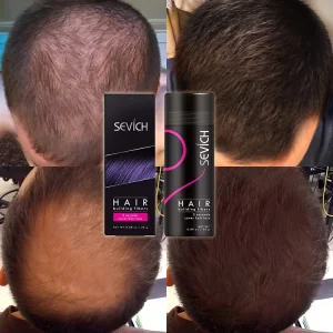Custom Logo Organic Styling Keratin Hair Fibre Powder Spray Applicator Hair Building Fibers