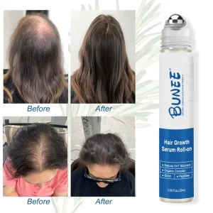 Custom Logo Scalp Repair Essence Advanced Hair Growth Roll on Serum for Hair Treatment High Demand Products