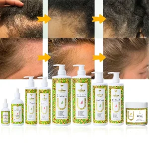 Custom Private Label Rosemary Mint Tea Tree Oil Hair Growth Shampoo and Conditioner Organic Biotin Shampoo to Grow Hair