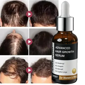 Customized 30ml Brand Advanced Hair Scalp Growth Serum 3% Redensyl + 3% Procapil + 3% Anagain with Natural Ingredients