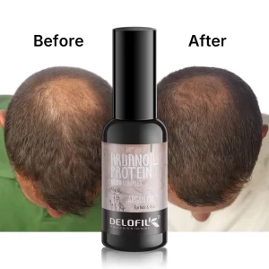 Delofil Anti Hair Loss Fast Hair Growth Oil Thickening Hair Moisturizing Smooth Regrowth Treatment Essence Oil for Women and Men