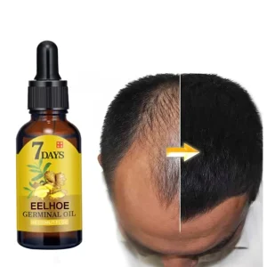 EELHOE Germinal Oil 10ml 20ml 40ml Ginger Hair Growth Hair Caring Moisturizing Anti Falling Oil Serum Women