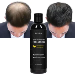 Eco Friendly Hair Care Product Hair Regrowth Shampoo Prevents Hair Loss Shampoo and Conditioner
