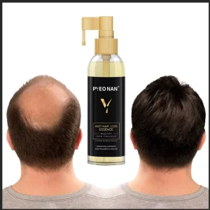 Essential Oil Set for Hair Loss Prevention Serum and Anti Hair Loss Lotion Hair Treatment Growth Oil Serum Scalp Treatment Oil